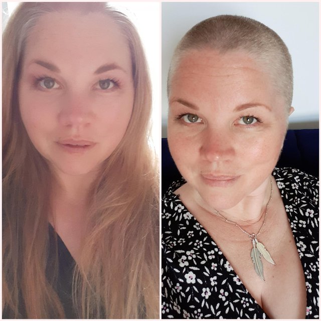 Sarah before and after her head shave for Hospiscare